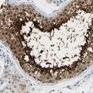 Anti-TXNDC2 antibody produced in rabbit 