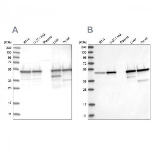 Anti-TXNDC5 antibody produced in rabbit 