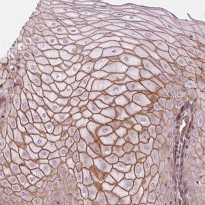 Anti-TXNIP antibody produced in rabbit 