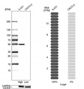 Anti-TYMP antibody produced in rabbit 