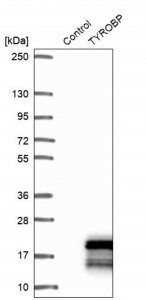 Anti-TYROBP antibody produced in rabbit 