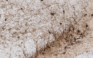 Anti-Tyrosine Hydroxylase Antibody, clone 20/40/15 ZooMAb Mouse Monoclonal 