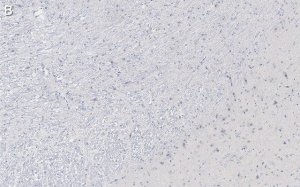 Anti-Tyrosine Hydroxylase Antibody, clone 20/40/15 ZooMAb Mouse Monoclonal 