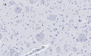 Anti-Tyrosine Hydroxylase Antibody, clone 3M12, ZooMAb Rabbit Monoclonal 