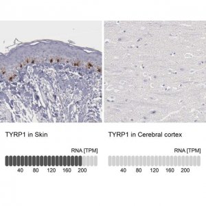 Anti-TYRP1 antibody produced in rabbit HPA000937-100UL