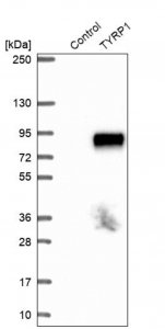 Anti-TYRP1 antibody produced in rabbit HPA000937-100UL