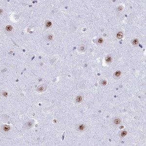 Anti-U2AF1 antibody produced in rabbit 