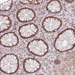 Anti-U2AF2 antibody produced in rabbit HPA043562-100UL