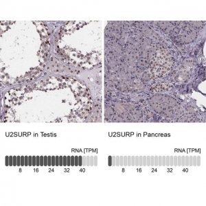 Anti-U2SURP antibody produced in rabbit 