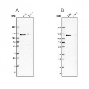 ANTI-UBA1 antibody produced in rabbit HPA000289-100UL