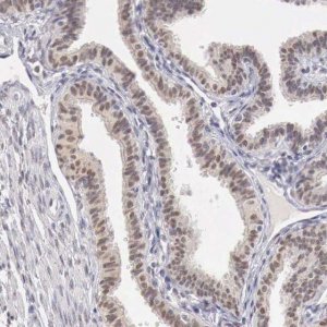 ANTI-UBA1 antibody produced in rabbit HPA000289-100UL