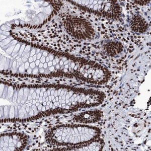 Anti-UBA2 antibody produced in rabbit 