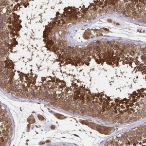 Anti-UBE2M antibody produced in rabbit HPA054551-100UL