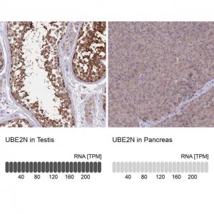 Anti-UBE2N antibody produced in rabbit 