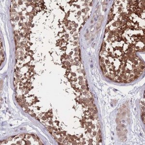Anti-UBE2N antibody produced in rabbit 
