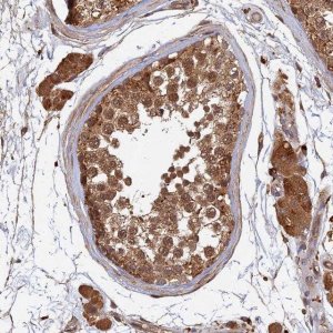 Anti-UBE2W antibody produced in rabbit HPA045161-100UL