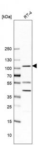 Anti-UBE3A antibody produced in rabbit 