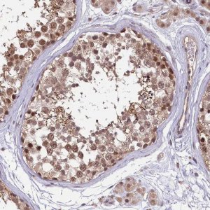 Anti-UBE3A antibody produced in rabbit 