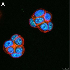 Anti-Ubiquilin 4 Antibody, clone 5K6 ZooMAb Rabbit Monoclonal 