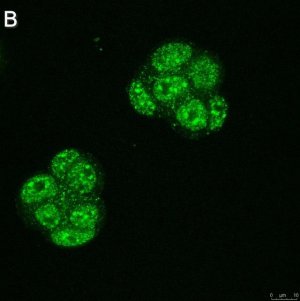 Anti-Ubiquilin 4 Antibody, clone 5K6 ZooMAb Rabbit Monoclonal 