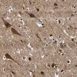 Anti-UBQLN2 antibody produced in rabbit 