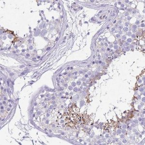 Anti-UBQLN3 antibody produced in rabbit 