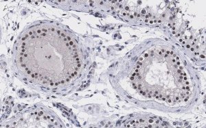 Anti-UBR5 Antibody, clone 2F14 ZooMAb Rabbit Monoclonal 