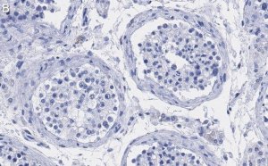 Anti-UBR5 Antibody, clone 2F14 ZooMAb Rabbit Monoclonal 