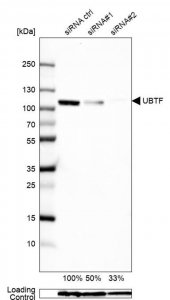 Anti-UBTF antibody produced in rabbit 
