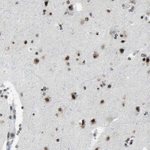 Anti-UBTF antibody produced in rabbit 