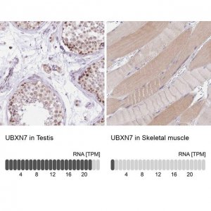 Anti-UBXN7 antibody produced in rabbit 