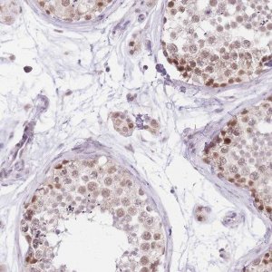 Anti-UBXN7 antibody produced in rabbit 