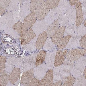 Anti-UCP3 antibody produced in rabbit 