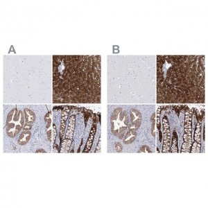 Anti-UGDH antibody produced in rabbit 