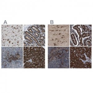 Anti-UGGT1 antibody produced in rabbit HPA015127-100UL