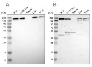 Anti-UGGT1 antibody produced in rabbit HPA015127-100UL