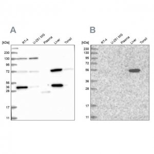 Anti-UGP2 antibody produced in rabbit HPA034697-100UL
