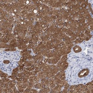 Anti-UGP2 antibody produced in rabbit HPA034697-100UL