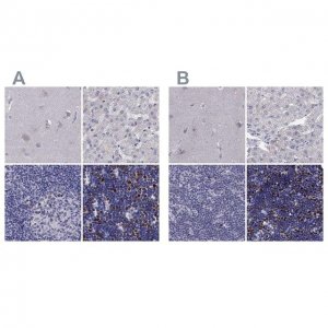 Anti-UHRF1 antibody produced in rabbit 