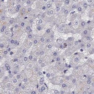 Anti-UHRF1 antibody produced in rabbit 