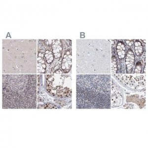 Anti-UIMC1 antibody produced in rabbit HPA037503-100UL