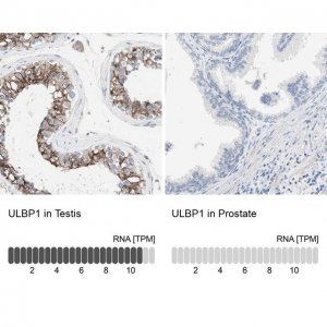 Anti-ULBP1 antibody produced in rabbit 