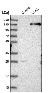 Anti-ULK2 antibody produced in rabbit 