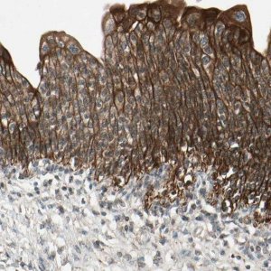 Anti-ULK2 antibody produced in rabbit 