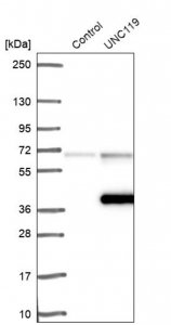 Anti-UNC119 antibody produced in rabbit 
