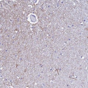 Anti-UNC80 antibody produced in rabbit 