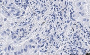 Anti-uPAR Antibody, clone 2G10 , ZooMAb Rabbit Monoclonal 
