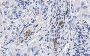 Anti-uPAR Antibody, clone 2G10 , ZooMAb Rabbit Monoclonal 