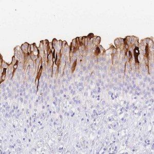 Anti-UPK1A antibody produced in rabbit 