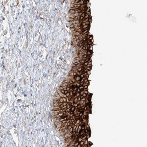 Anti-UPK1B antibody produced in rabbit 